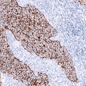 Anti-CLDN3 antibody produced in mouse Prestige Antibodies&#174; Powered by Atlas Antibodies, clone CL13128, purified by using Protein A, buffered aqueous glycerol solution