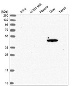 Anti-ACOT1 antibody produced in rabbit Prestige Antibodies&#174; Powered by Atlas Antibodies, affinity isolated antibody, buffered aqueous glycerol solution
