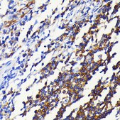Anti-NF-κB2 Antibody, clone 4K3V3, Rabbit Monoclonal