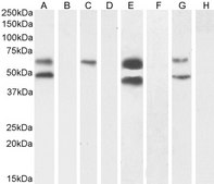 Anti-CAMK2A antibody produced in goat affinity isolated antibody, buffered aqueous solution