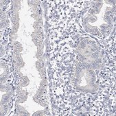 Anti-CYP2E1 antibody produced in rabbit Prestige Antibodies&#174; Powered by Atlas Antibodies, affinity isolated antibody, buffered aqueous glycerol solution