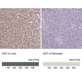 Anti-CAT antibody produced in rabbit Prestige Antibodies® Powered by Atlas Antibodies, affinity isolated antibody, buffered aqueous glycerol solution