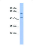 Anti-PTX3 antibody produced in rabbit affinity isolated antibody