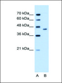 Anti-ADH1B antibody produced in rabbit IgG fraction of antiserum