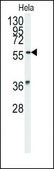 Anti-SENP3 (C-term) antibody produced in rabbit IgG fraction of antiserum, buffered aqueous solution