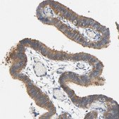 Anti-ARPC1A antibody produced in rabbit Prestige Antibodies&#174; Powered by Atlas Antibodies, affinity isolated antibody, buffered aqueous glycerol solution