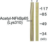 Anti-NF-κB p65 (Acetyl-Lys310) antibody produced in rabbit affinity isolated antibody