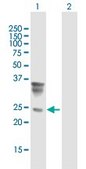 Anti-ORM2 antibody produced in mouse IgG fraction of antiserum, buffered aqueous solution