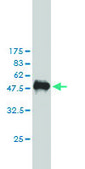 Monoclonal Anti-PKN2 antibody produced in mouse clone 3A7, purified immunoglobulin, buffered aqueous solution