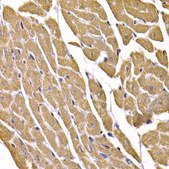 Anti-GLUT4 antibody produced in rabbit