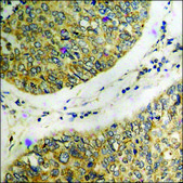 Anti-phospho-p70 S6 Kinase (pThr421) antibody produced in rabbit affinity isolated antibody