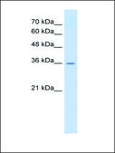 Anti-AGER affinity isolated antibody