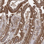 Anti-PLEKHA7 antibody produced in rabbit Prestige Antibodies&#174; Powered by Atlas Antibodies, affinity isolated antibody, buffered aqueous glycerol solution