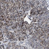 Anti-CCM2 antibody produced in rabbit Prestige Antibodies&#174; Powered by Atlas Antibodies, affinity isolated antibody, buffered aqueous glycerol solution, Ab1
