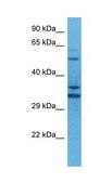 Anti-TEAD2 antibody produced in rabbit affinity isolated antibody