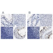 Anti-HOOK1 antibody produced in rabbit Prestige Antibodies&#174; Powered by Atlas Antibodies, affinity isolated antibody, buffered aqueous glycerol solution, Ab1