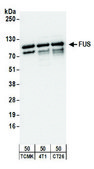 Rabbit anti-FUS Antibody, Affinity Purified Powered by Bethyl Laboratories, Inc.