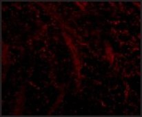 Anti-TOM70 antibody produced in rabbit affinity isolated antibody, buffered aqueous solution