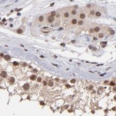 Anti-TERF2 antibody produced in rabbit Prestige Antibodies&#174; Powered by Atlas Antibodies, affinity isolated antibody, buffered aqueous glycerol solution