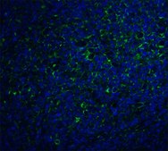 Anti-IL-17 (ab2) antibody produced in rabbit affinity isolated antibody, buffered aqueous solution