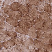 Anti-CHCHD3 antibody produced in rabbit Prestige Antibodies&#174; Powered by Atlas Antibodies, affinity isolated antibody, buffered aqueous glycerol solution