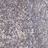 Anti-RUNX1 antibody produced in rabbit Prestige Antibodies&#174; Powered by Atlas Antibodies, affinity isolated antibody, buffered aqueous glycerol solution
