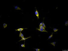 OSUMMER.11 Mouse NRAS-Mutant Melanoma Cell Line