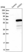 Anti-CASQ1 antibody produced in rabbit Prestige Antibodies&#174; Powered by Atlas Antibodies, affinity isolated antibody, buffered aqueous glycerol solution