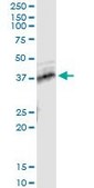 Monoclonal Anti-TNFRSF10B antibody produced in mouse clone 2D6, purified immunoglobulin, buffered aqueous solution