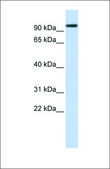 Anti-ACE2 antibody produced in rabbit affinity isolated antibody