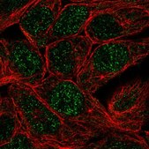 Anti-CA12 antibody produced in rabbit Prestige Antibodies&#174; Powered by Atlas Antibodies, affinity isolated antibody, buffered aqueous glycerol solution
