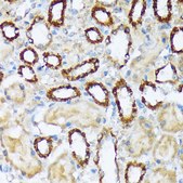 Anti-WAVE2/WASF2 Antibody, clone 7A6C10, Rabbit Monoclonal