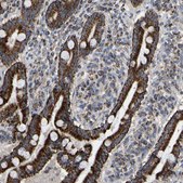 Anti-CBLB antibody produced in rabbit Prestige Antibodies&#174; Powered by Atlas Antibodies, affinity isolated antibody, buffered aqueous glycerol solution