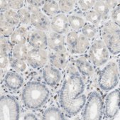Anti-P2RY1 antibody produced in rabbit Prestige Antibodies&#174; Powered by Atlas Antibodies, affinity isolated antibody, buffered aqueous glycerol solution
