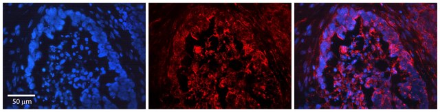 Anti-FOXO3 antibody produced in rabbit affinity isolated antibody