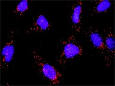 Anti-MAP3K14 antibody produced in rabbit purified immunoglobulin, buffered aqueous solution