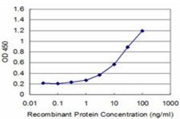 Monoclonal Anti-SPOP, (C-terminal) antibody produced in mouse clone 3E2, purified immunoglobulin, buffered aqueous solution