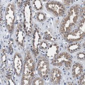 Anti-PDCD6IP antibody produced in rabbit Prestige Antibodies&#174; Powered by Atlas Antibodies, affinity isolated antibody, buffered aqueous glycerol solution