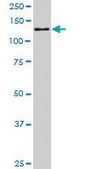 Monoclonal Anti-CAND1 antibody produced in mouse clone 5F2, purified immunoglobulin, buffered aqueous solution