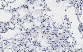 Anti-MRC1 Antibody, clone 1C9 ZooMAb&#174; Rabbit Monoclonal recombinant, expressed in HEK 293 cells