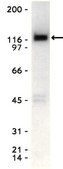 Anti-Eck/EphA2 Antibody, clone D7 clone D7, Upstate&#174;, from mouse