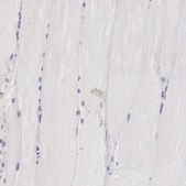 Anti-CLU antibody produced in rabbit Prestige Antibodies&#174; Powered by Atlas Antibodies, affinity isolated antibody, buffered aqueous glycerol solution