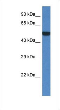 Anti-PORCN antibody produced in rabbit affinity isolated antibody