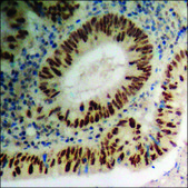 Anti-phospho-TIE2 (pTyr1108) antibody produced in rabbit affinity isolated antibody
