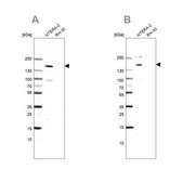 Anti-SALL4 antibody produced in rabbit Prestige Antibodies® Powered by Atlas Antibodies, affinity isolated antibody, buffered aqueous glycerol solution