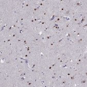 Anti-TBR1 Prestige Antibodies&#174; Powered by Atlas Antibodies, affinity isolated antibody