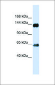 Anti-RAPGEF1 antibody produced in rabbit affinity isolated antibody