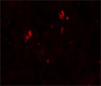 Anti-SUMO2/3 antibody produced in rabbit affinity isolated antibody, buffered aqueous solution