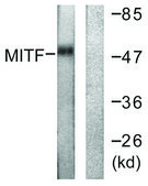 Anti-MITF antibody produced in rabbit affinity isolated antibody