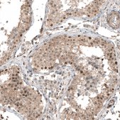 Monoclonal Anti-SMAD4 antibody produced in mouse Prestige Antibodies&#174; Powered by Atlas Antibodies, clone CL9774, purified immunoglobulin, buffered aqueous glycerol solution